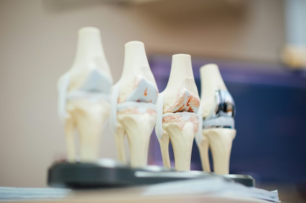 orthopedic research