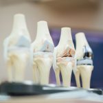 Understanding the Impact of Orthopedic Research on Patient Care